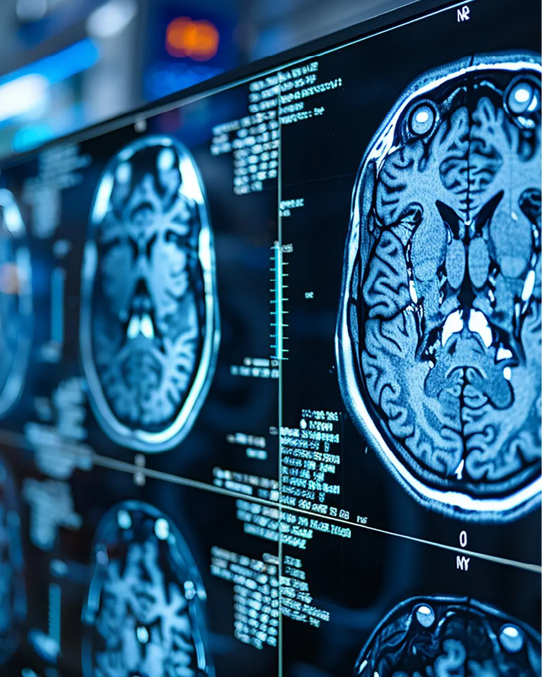 Module 5: From Scans to Brain MRI Basics and Safety Issues